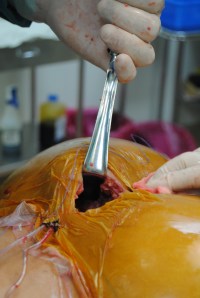 after the implant is placed within the muscle it is invisible to the eye