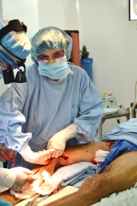 performing a saphenectomy